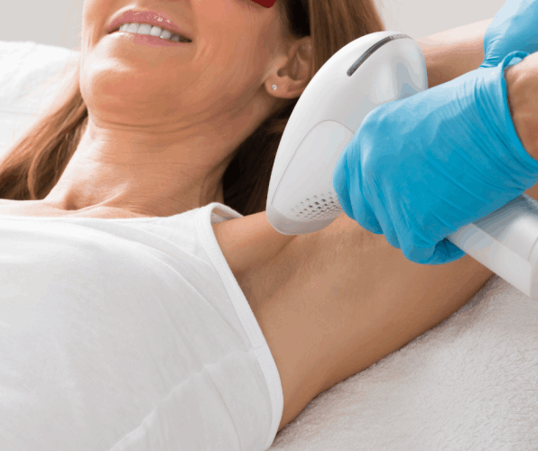 Depilação a laser axilas braço, suvaco Contagem