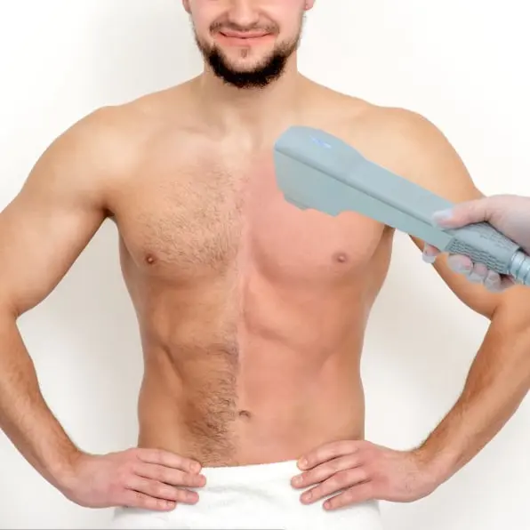 Depilação a laser peito peitoral Contagem