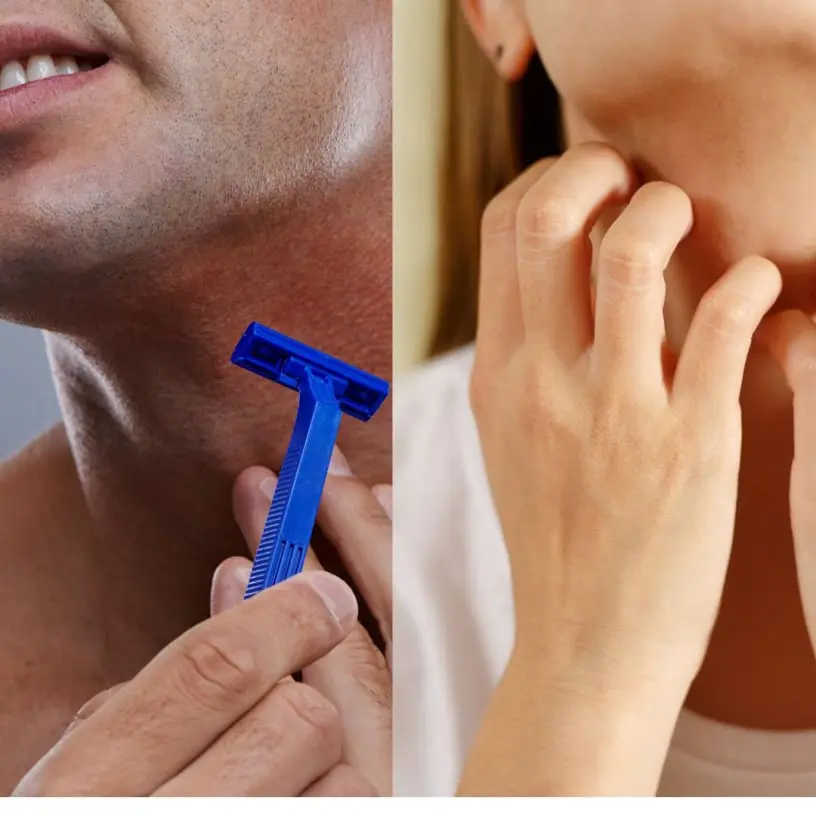 Depilação com gilete irrita sua pele e pode causar foliculite, depilação com cera é dolorosa e gastava muito tempo e dinheiro. Com a depilação a laser o tratamento é definitivo e você vai sentir sua pela mais lisa e higiênica. Entre em contato com um de nossos especialistas e vamos esclarecer todas as suas Dúvidas!